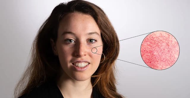 Jakie kwasy do cery naczynkowej: unikaj błędów w pielęgnacji Jakie kwasy do cery naczynkowej: unikaj błędów w pielęgnacji