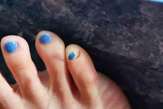 Czy paznokcie muszą odpocząć od hybrydy? Sprawdź, co musisz wiedzieć Czy paznokcie muszą odpocząć od hybrydy? Sprawdź, co musisz wiedzieć